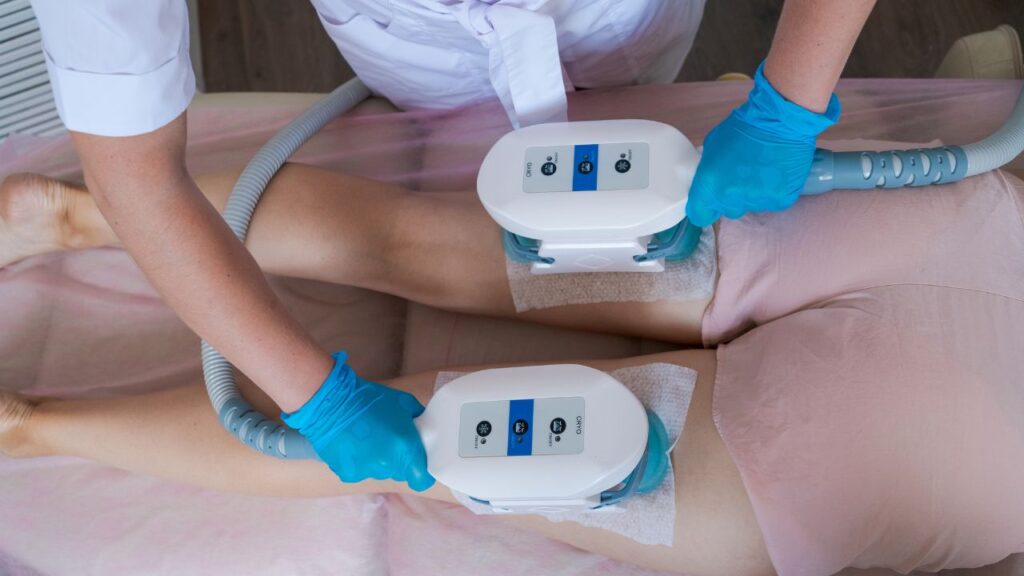 CoolSculpting