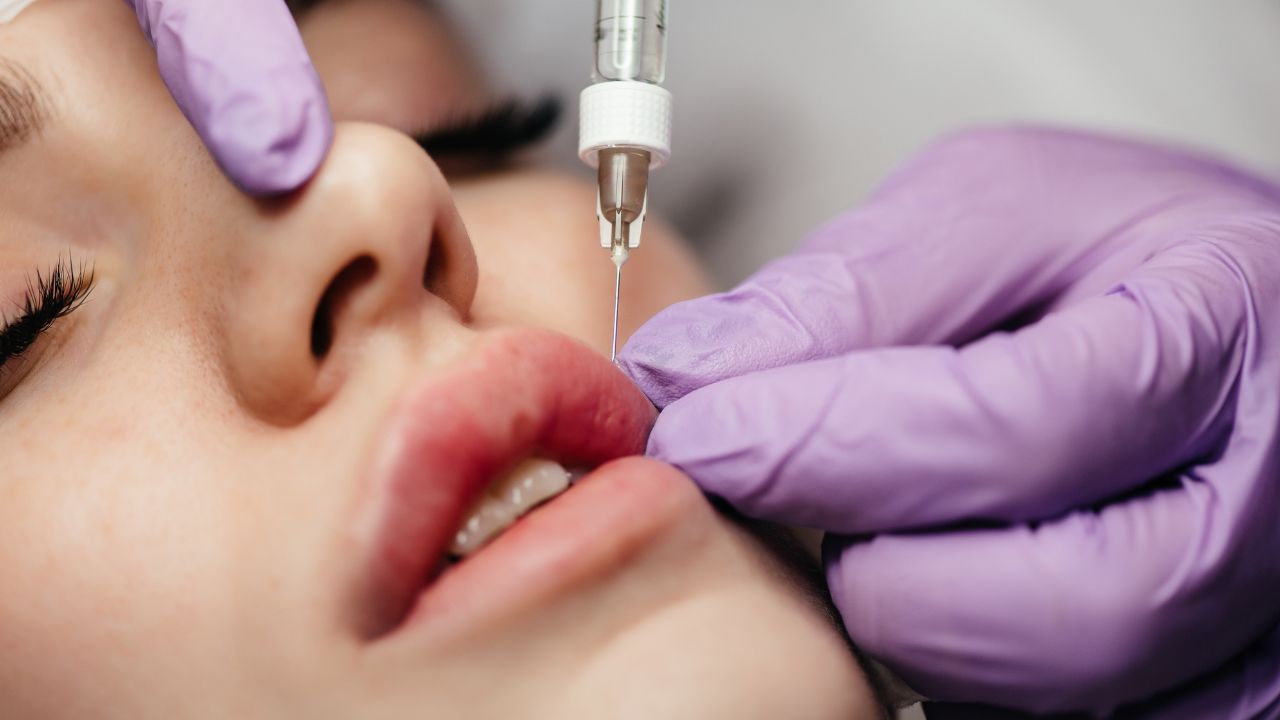 Factors Affecting The Cost of Lip Fillers