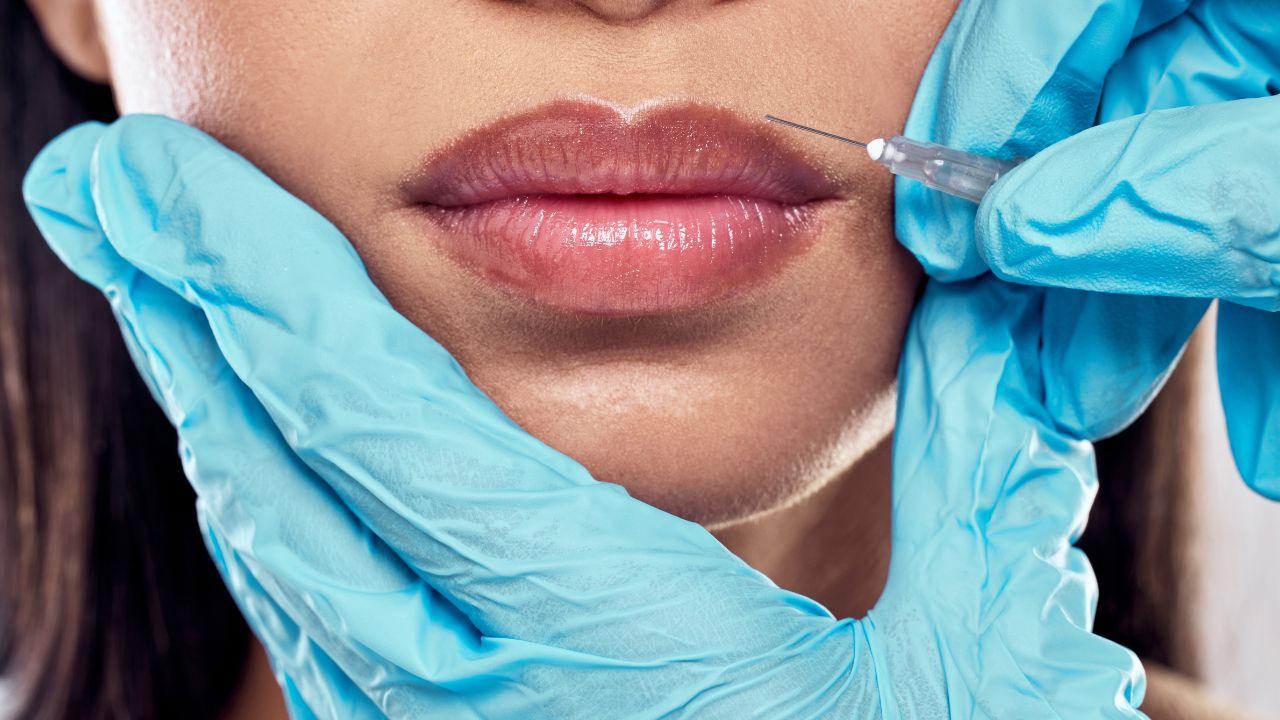 injectables-and-fillers (4)