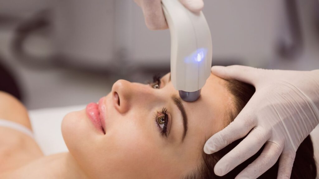 Laser Skin Tightening