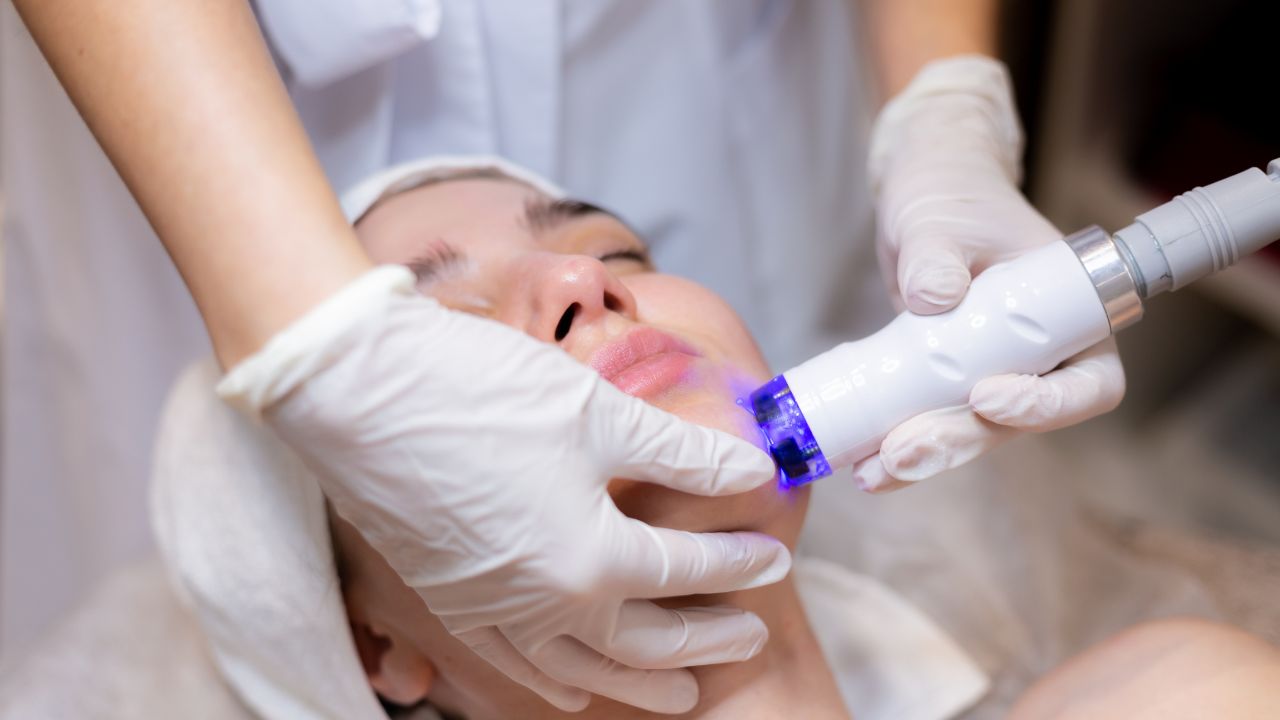 laser-skin-tightening (2)