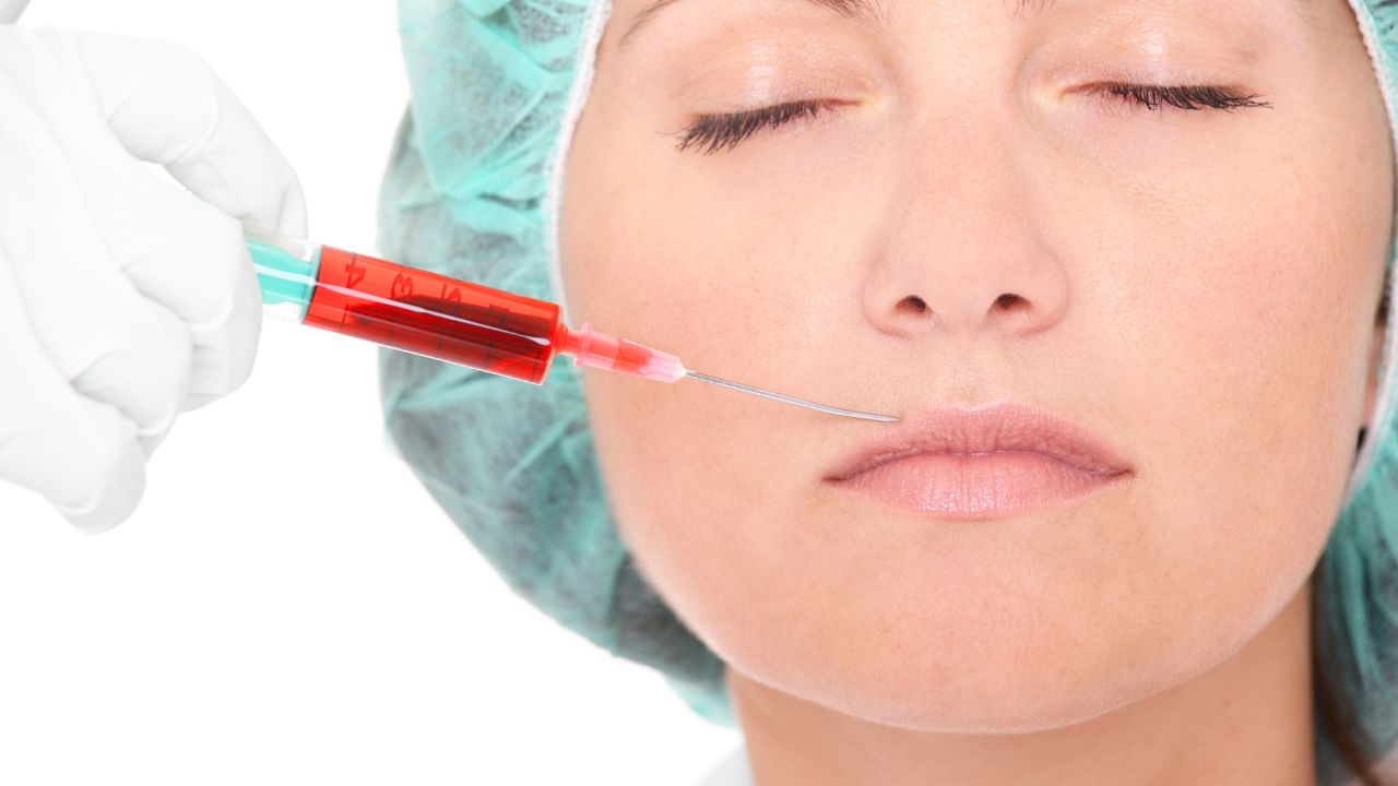 Lip enhancement