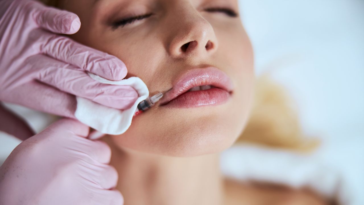 Lip enhancement