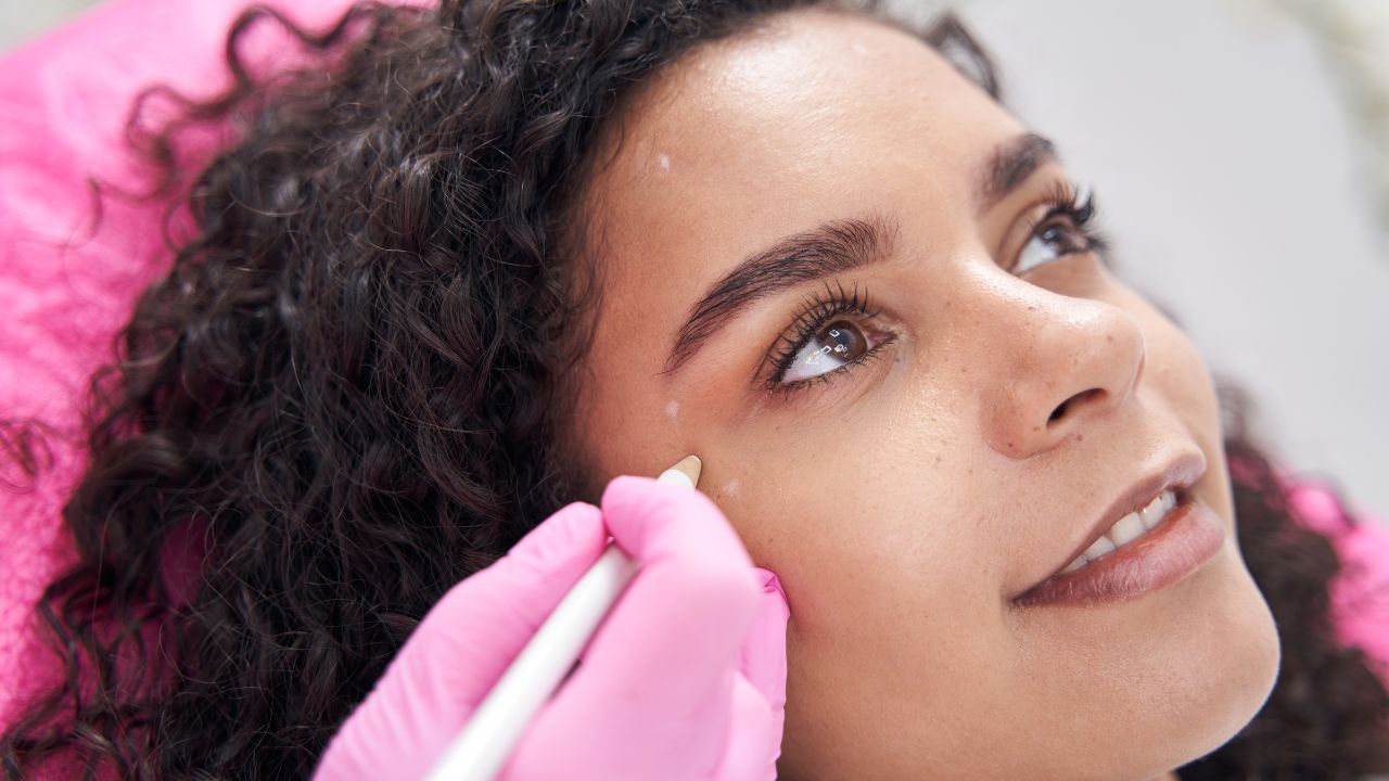 Facial Contouring