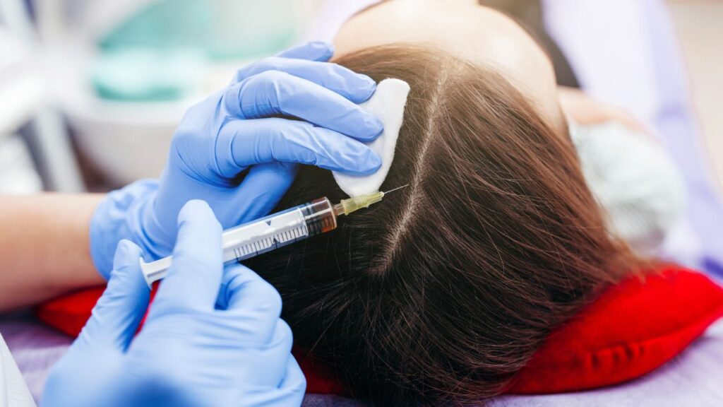 PRP Hair Treatment