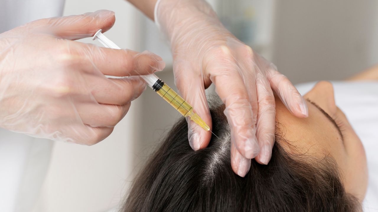 PRP Hair Treatment