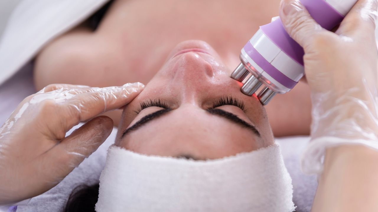 Radiofrequency Treatment