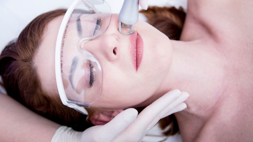 Skin Resurfacing Treatment