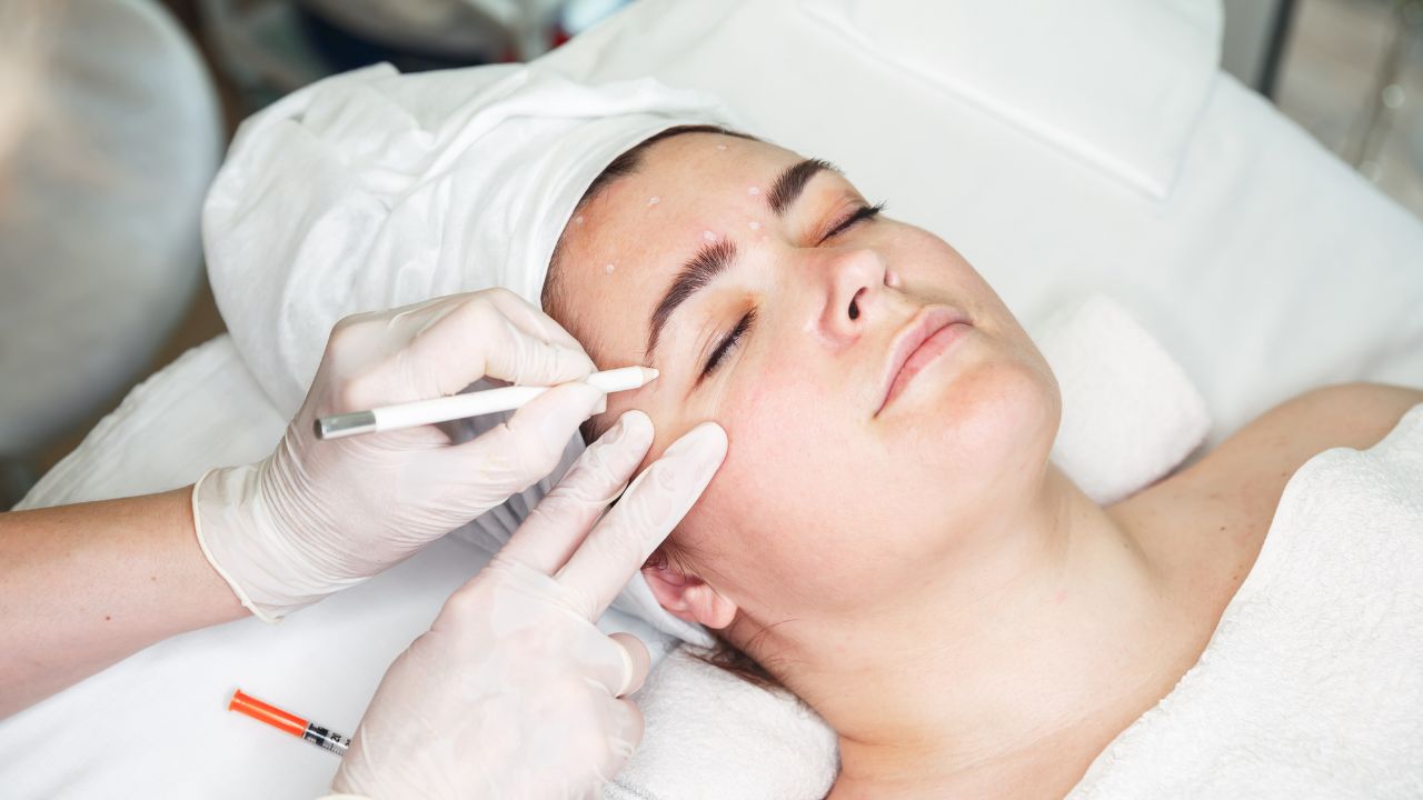 Wrinkle Reduction